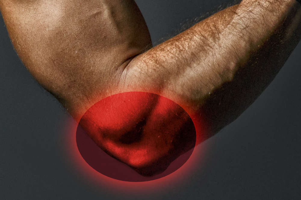 tennis_elbow_pain-2a